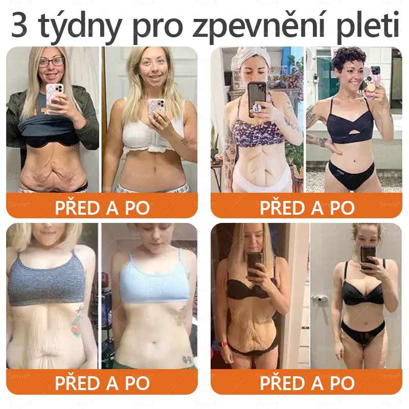 👩‍⚕️🐝Doporučení dermatologa 🐝 Sinvie® Včelím Jedem Krém na Opravu Pokožky 🔥 Český vývoj, výroba a dodávka v České republice