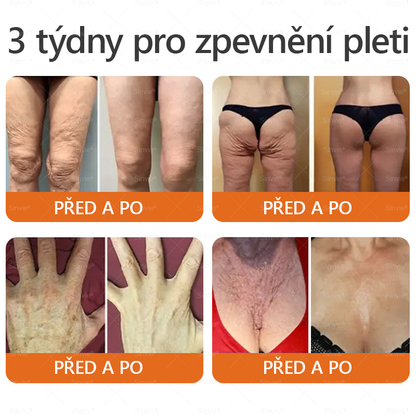 👩‍⚕️🐝Doporučení dermatologa 🐝 Sinvie® Včelím Jedem Krém na Opravu Pokožky 🔥 Český vývoj, výroba a dodávka v České republice