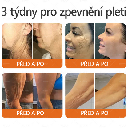 🔥🐝 Sinvie® Krém na obnovu pleti s včelím jedem(👨‍⚕‍CE schváleno)👍✅