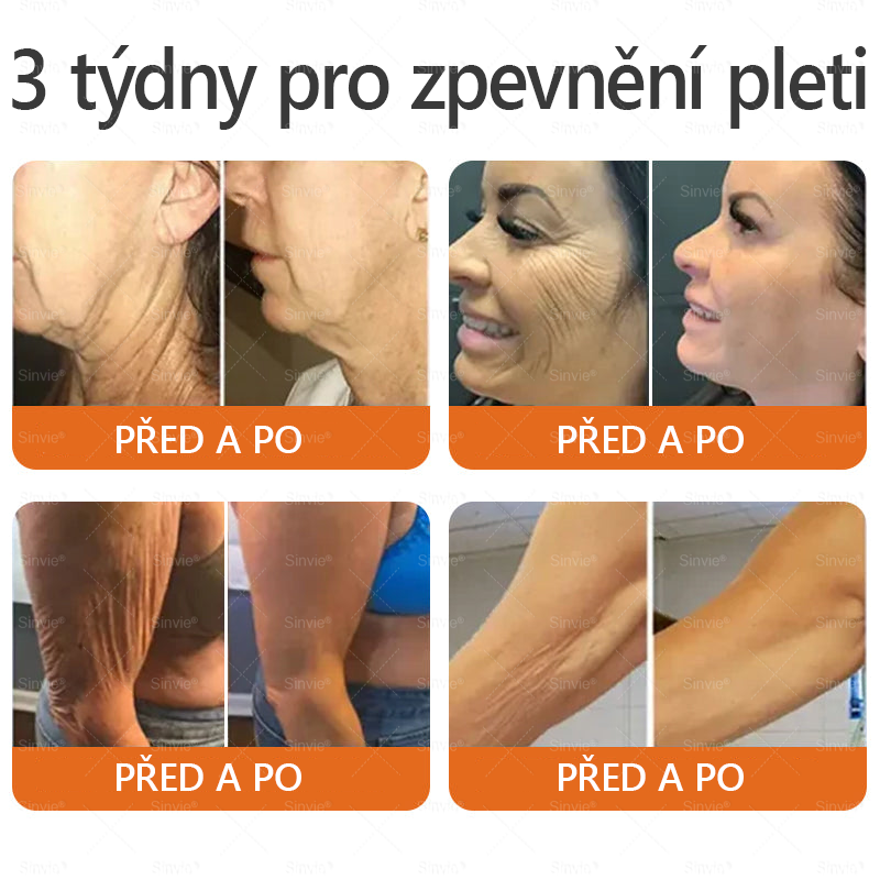 👩‍⚕️🐝Doporučení dermatologa 🐝 Sinvie® Včelím Jedem Krém na Opravu Pokožky 🔥 Český vývoj, výroba a dodávka v České republice