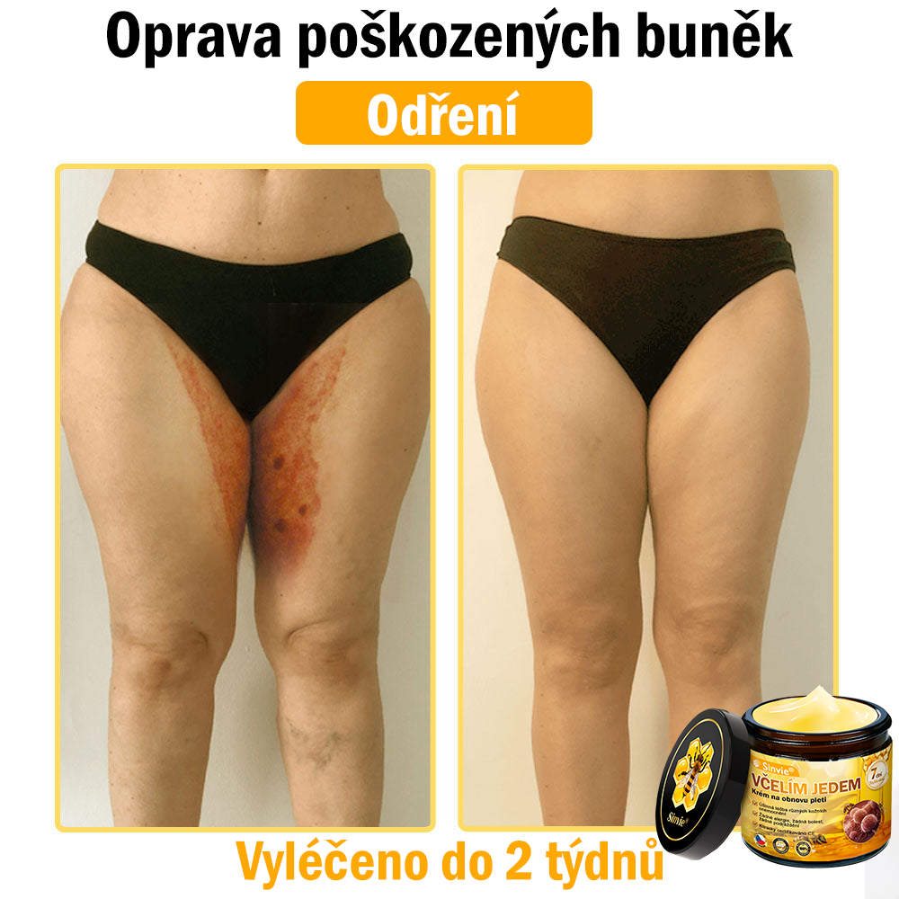 🔥🐝 Sinvie® Krém na obnovu pleti s včelím jedem(👨‍⚕‍CE schváleno)👍✅