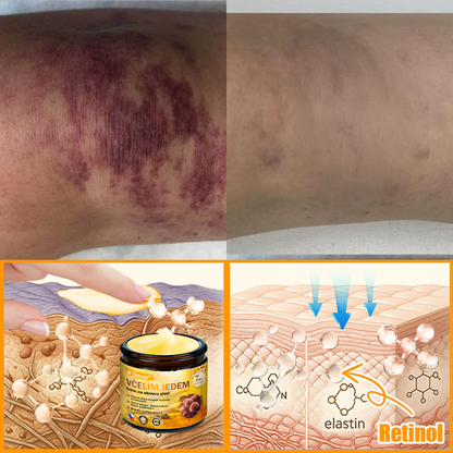 🔥🐝 Sinvie® Krém na obnovu pleti s včelím jedem(👨‍⚕‍CE schváleno)👍✅