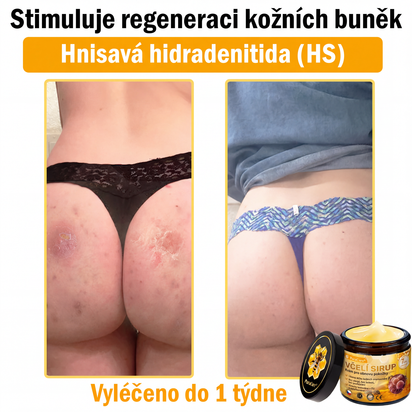 🩺🐝 PuraCure® Krém na obnovu pleti s včelím jedem(👨‍⚕‍CE schváleno)👍✅