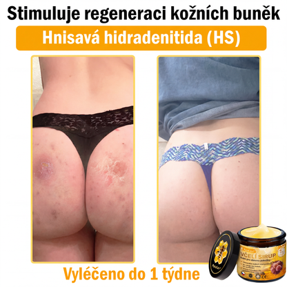 🩺🐝 PuraCure® Krém na obnovu pleti s včelím jedem(👨‍⚕‍CE schváleno)👍✅