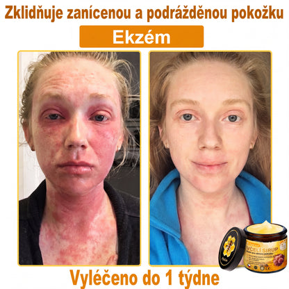 🩺🐝 PuraCure® Krém na obnovu pleti s včelím jedem(👨‍⚕‍CE schváleno)👍✅