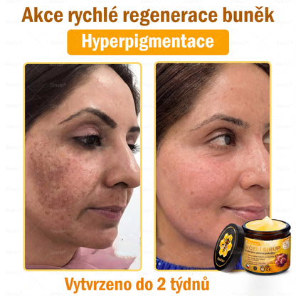 🩺🐝 PuraCure® Krém na obnovu pleti s včelím jedem(👨‍⚕‍CE schváleno)👍✅