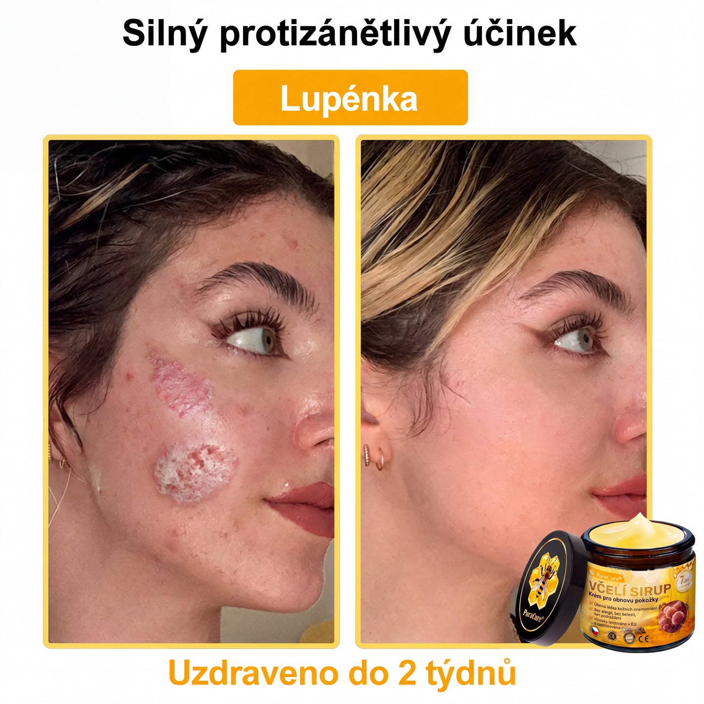 🩺🐝 PuraCure® Krém na obnovu pleti s včelím jedem(👨‍⚕‍CE schváleno)👍✅