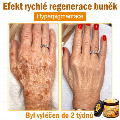 🩺🐝 PuraCure® Krém na obnovu pleti s včelím jedem(👨‍⚕‍CE schváleno)👍✅